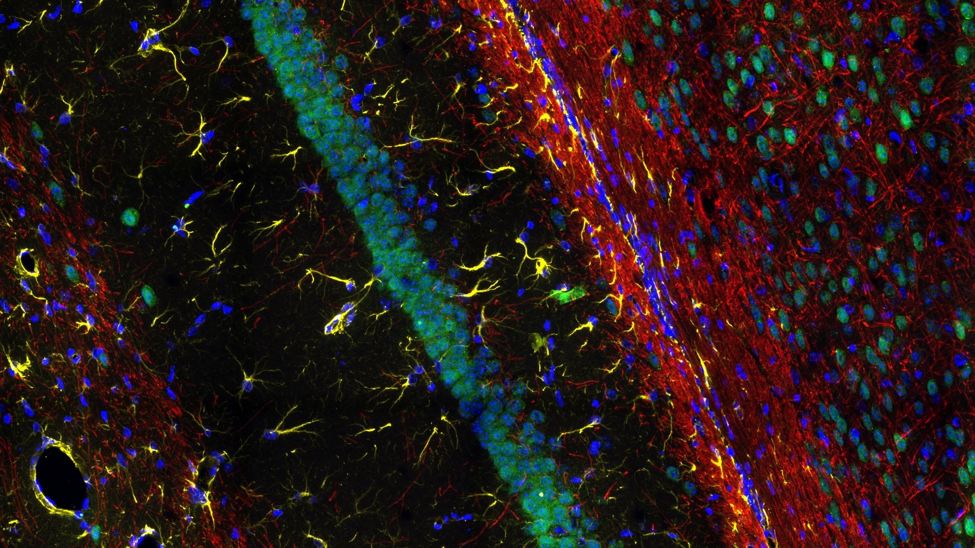 Spatial Proteomics
